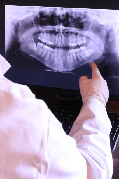 Best Broken or Chipped Tooth Repair in South Monroe, MI